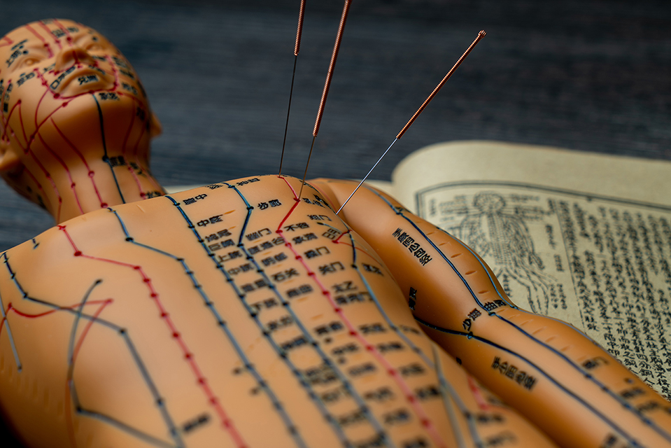 Traditional Cupping Therapy