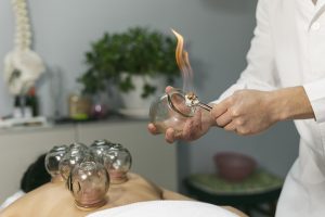 Fire cupping