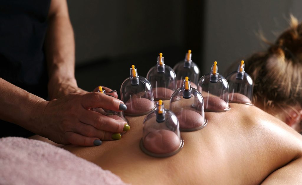 Types of Cupping therapy