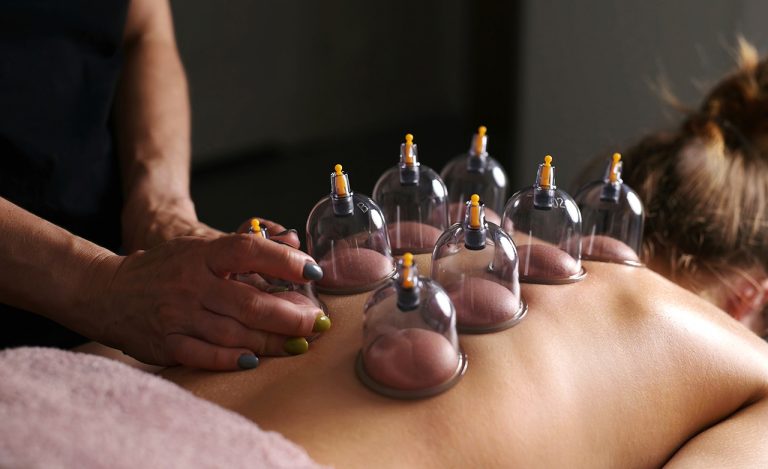 Types of Cupping therapy